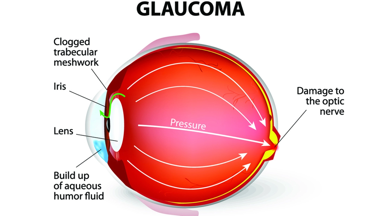 How to incorporate brinzolamide into your daily glaucoma management routine