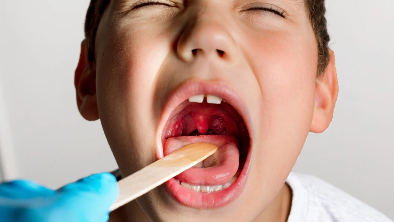 Can Allergies Cause Tonsillitis? Exploring the Link